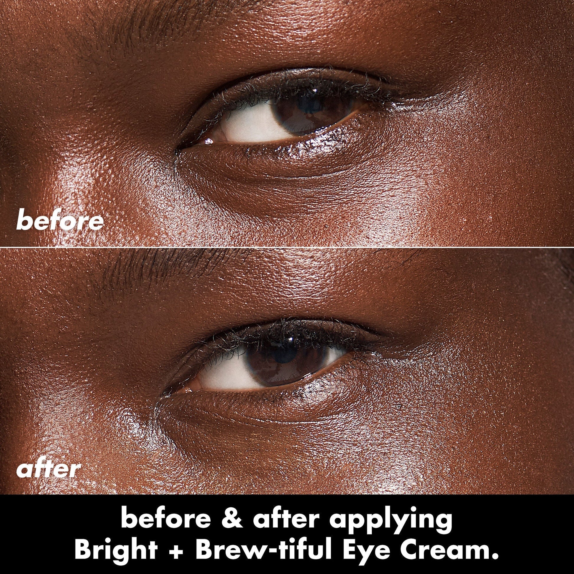 bright-brew-tiful-eye-cream-a0 0226_BBEC_Eye_BA_Diptych_607e3ec2-f0e1-4365-9b28-17574d841250.jpg