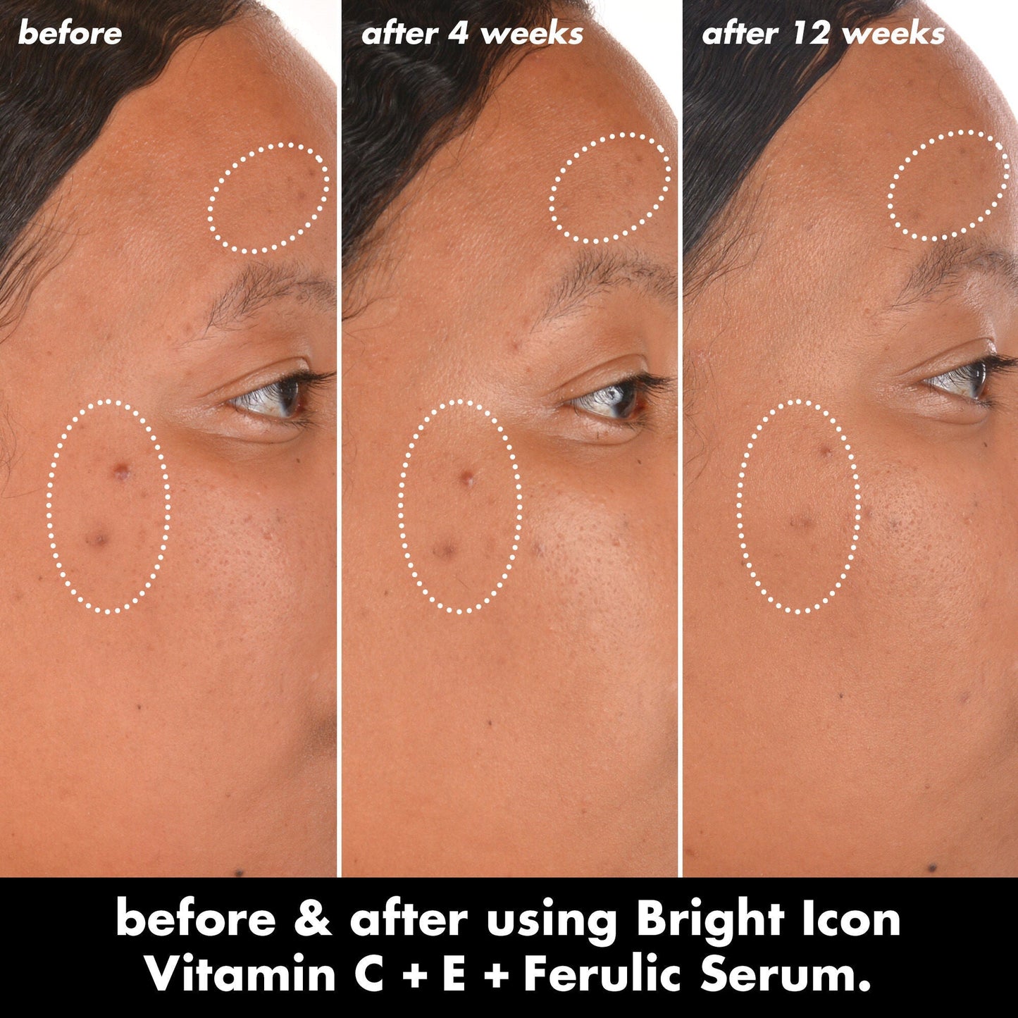 bright-icon-vitamin-c-e-ferulic-serum-t3 0226_EDU_BrightIconVitC_BA_Chanel_TRIPTYCH_c58f2fc8-209d-414f-9ba3-666a07a94887.jpg