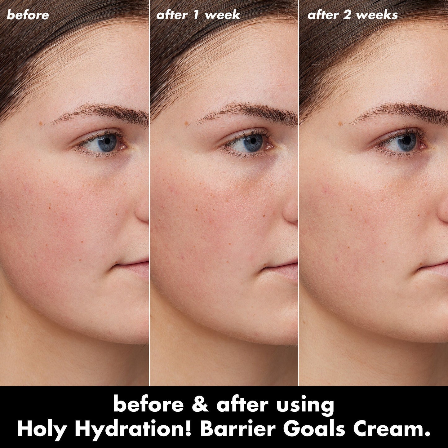 holy-hydration-barrier-goals-cream-j2 0226_EDU_HHBarrierGoalsCream_B_A_Zoe_TRYPTICH_710f5249-3a6b-41fd-89e4-817294dd9258.jpg