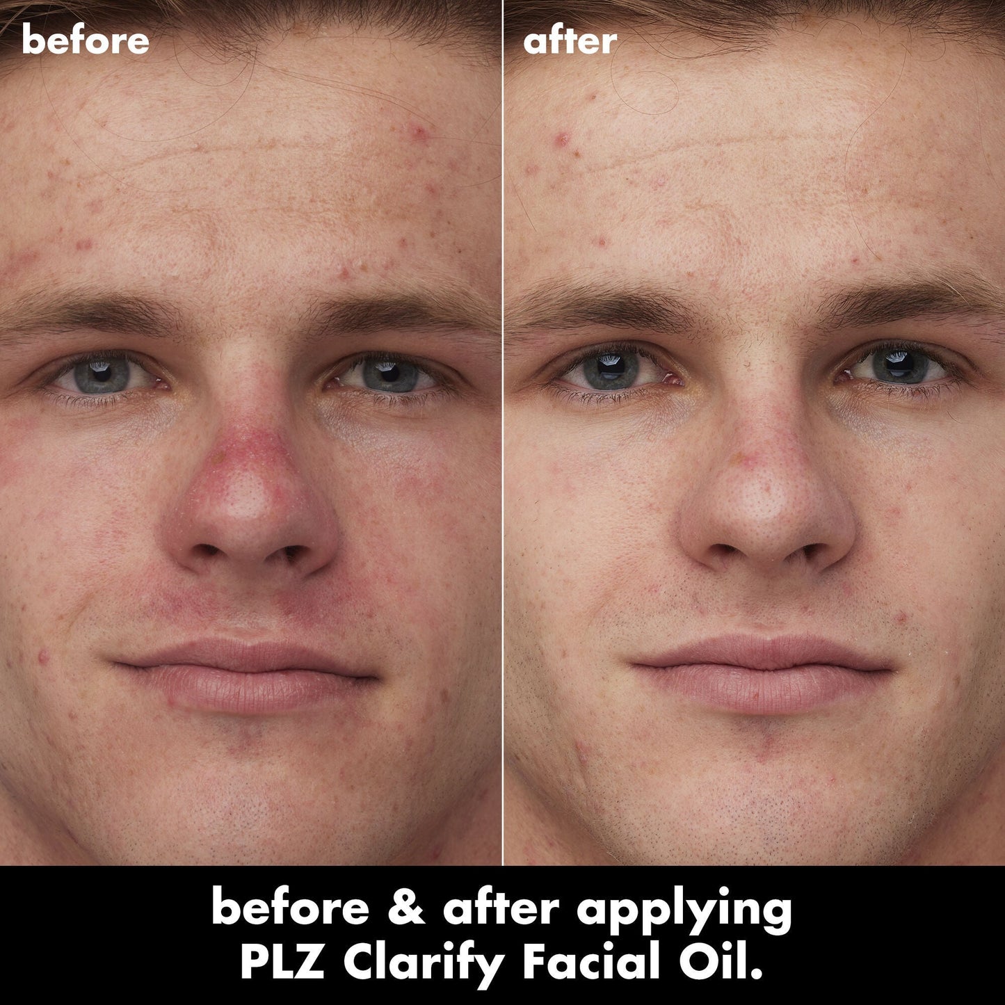 plz-clarify-facial-oil-f2 0326_EDU_PlzClarify_BA_Caleb.jpg