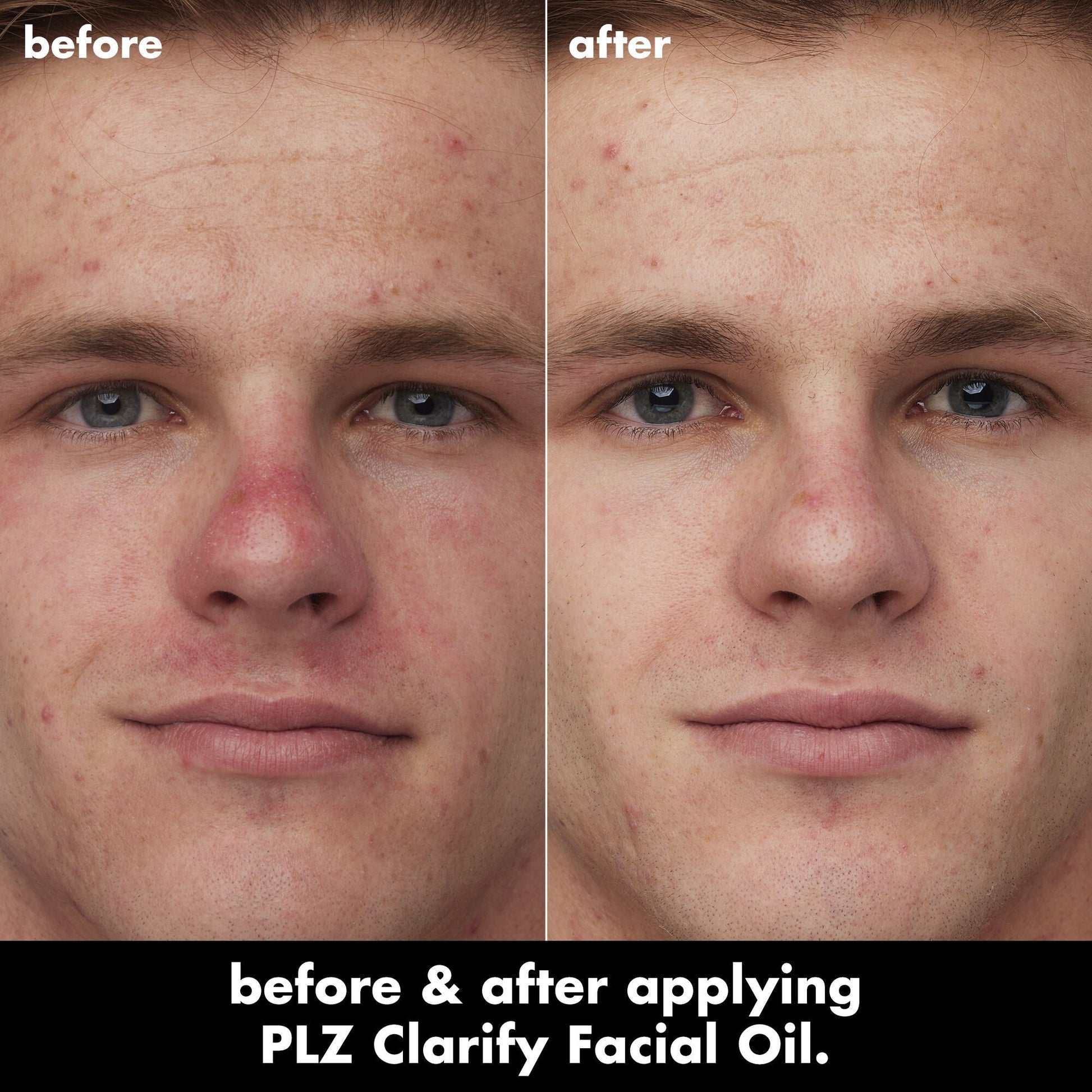 plz-clarify-facial-oil-f2 0326_EDU_PlzClarify_BA_Caleb.jpg