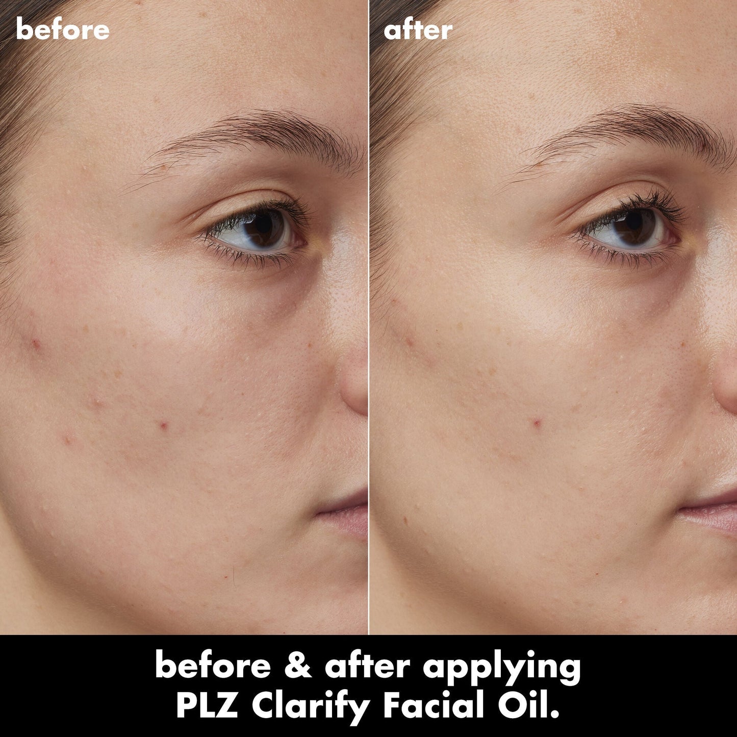 plz-clarify-facial-oil-f2 0326_EDU_PlzClarify_BA_Kelly.jpg