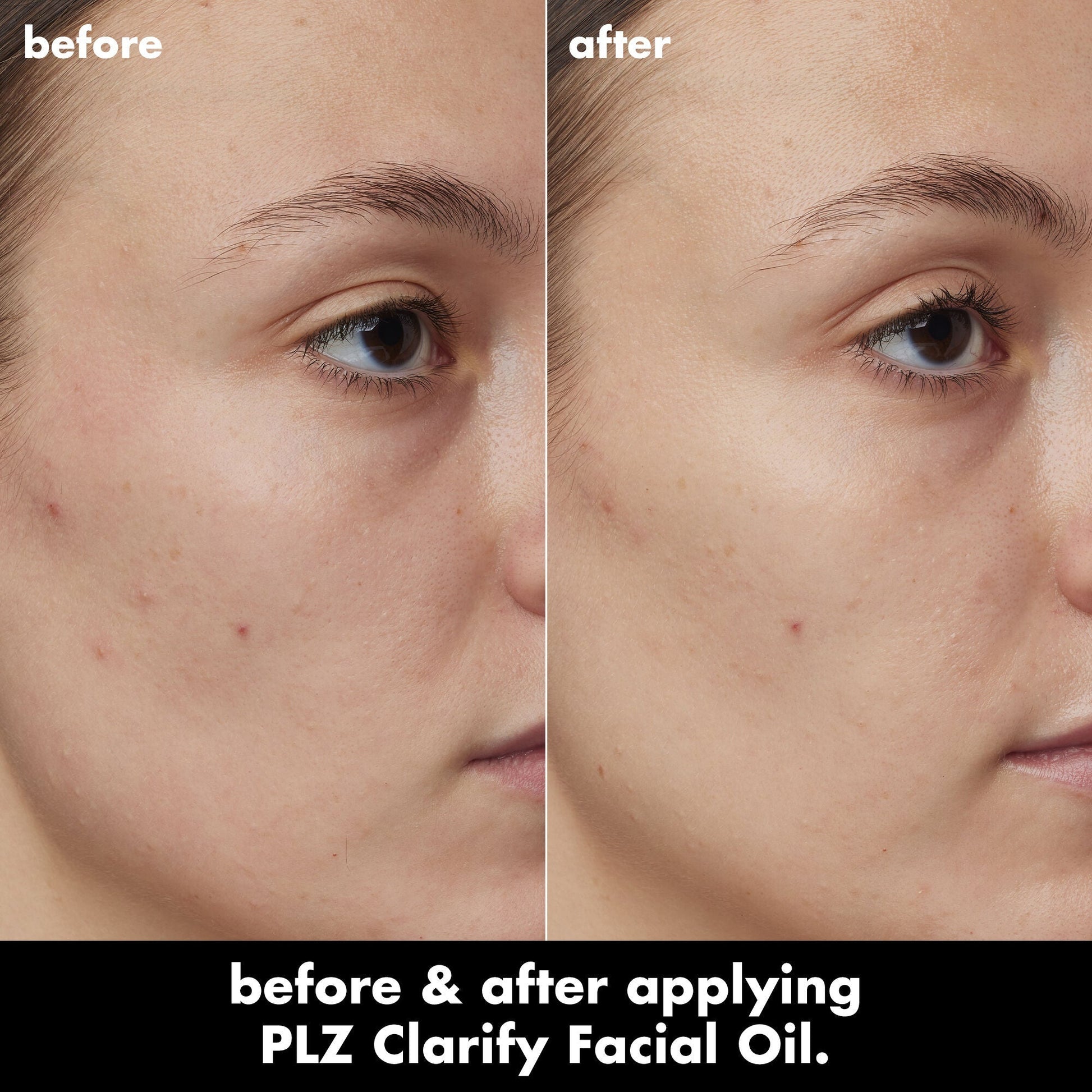 plz-clarify-facial-oil-f2 0326_EDU_PlzClarify_BA_Kelly.jpg