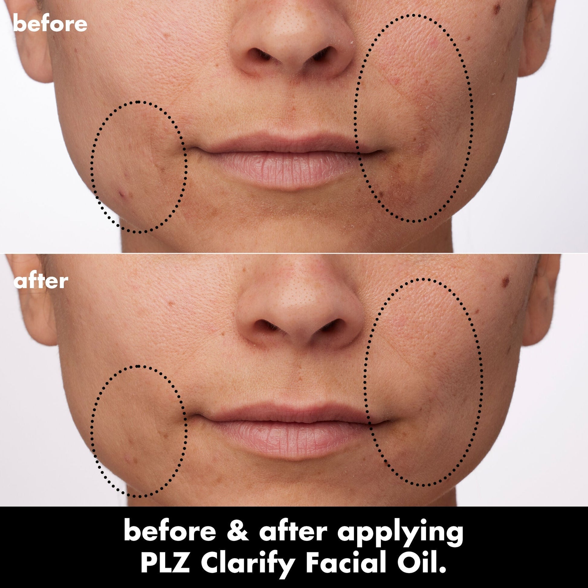 plz-clarify-facial-oil-f2 0326_EDU_PlzClarify_BA_Paula.jpg