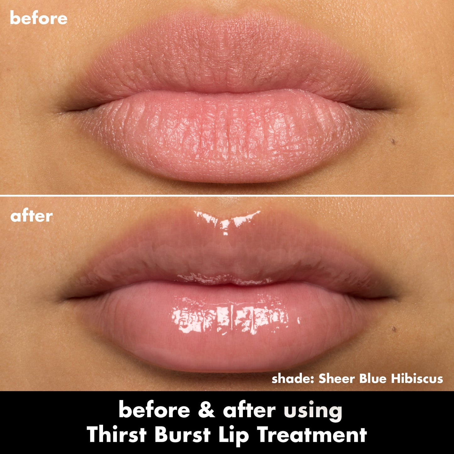 thirst-burst-lip-treatment-x5 0526_SEO_ThirstBurstLipTreatment_BA_SheerBlueHibiscus.jpg