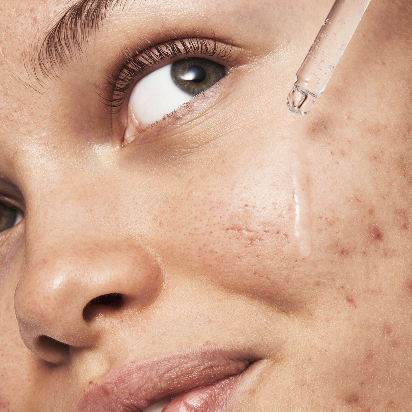 blemish-breakthrough-triple-acid-resurfacing-serum-d2 121321_Marley-Acne-Regimen_0254_FINAL_IGF.jpg