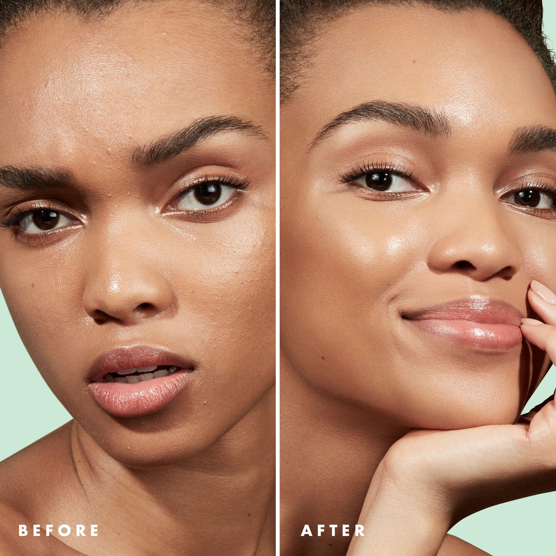 blemish-control-face-primer-large-size-w4 Primer_PP_Before_After_BlemishControl_2000x2000_3774231e-d4e1-49dd-b3d7-a73cbac901fe.jpg
